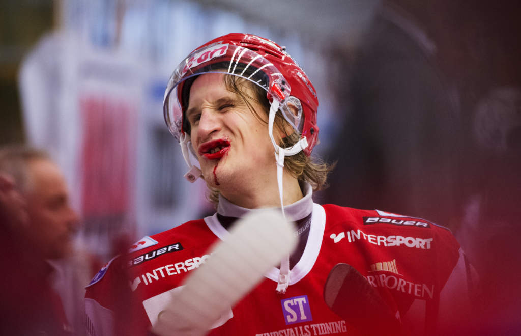 121117 Ishockey, Elitserien, Timr - Frjestad: Jonathan Hedstrm, Timr, efter att ha ftt ett slag mot munnen.
© Bildbyrn - 86318 - Foto: Joel Marklund / BILDBYRN